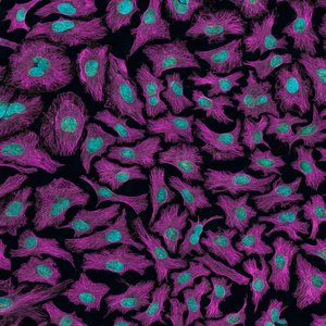 national-cancer-institute-c-wqrSCjVf4-unsplash